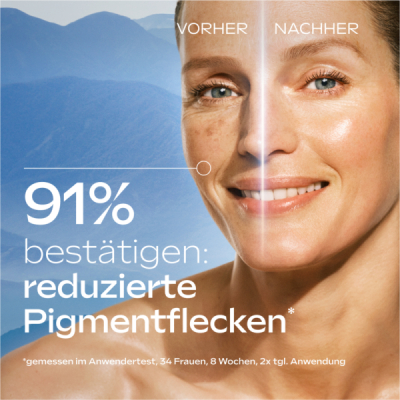 Weleda Anti-Pigmentflecken Bright Serum 30 ml